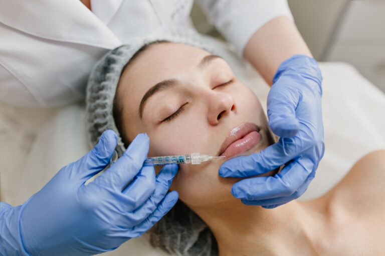 Lip Filler